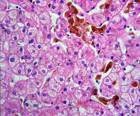 Biopsias