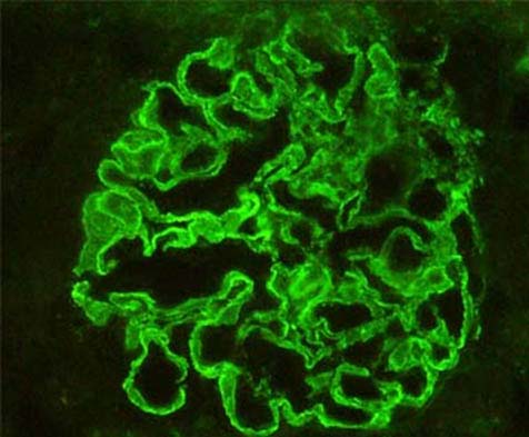 Inmunohistoquimica y Tecnicas Especiales
